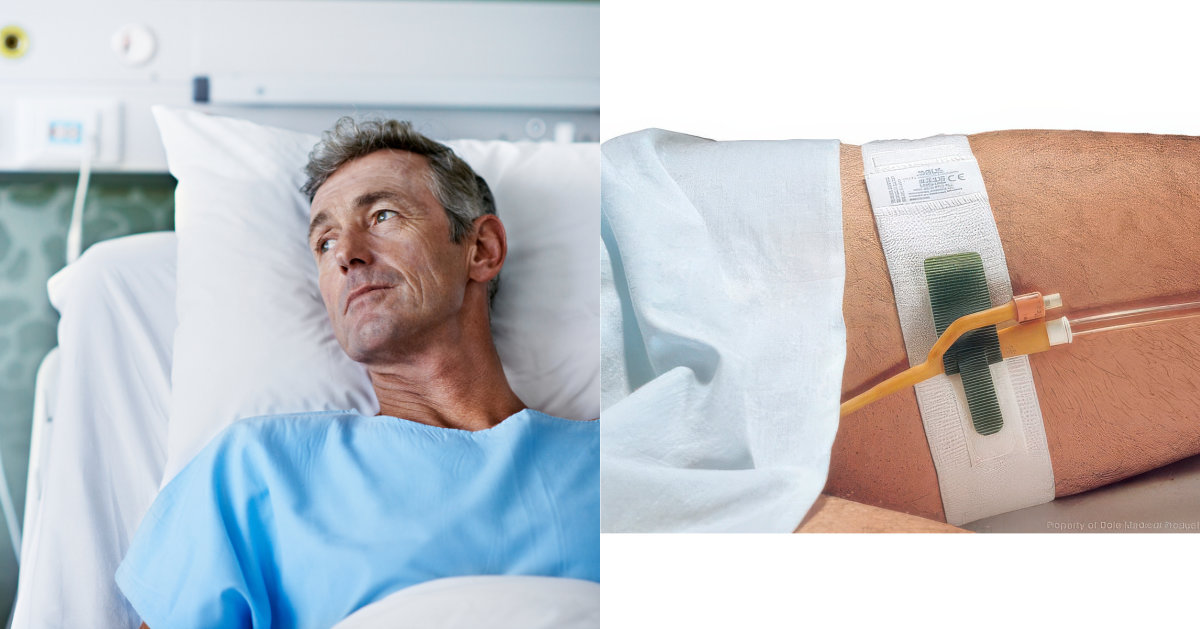 Catheter 