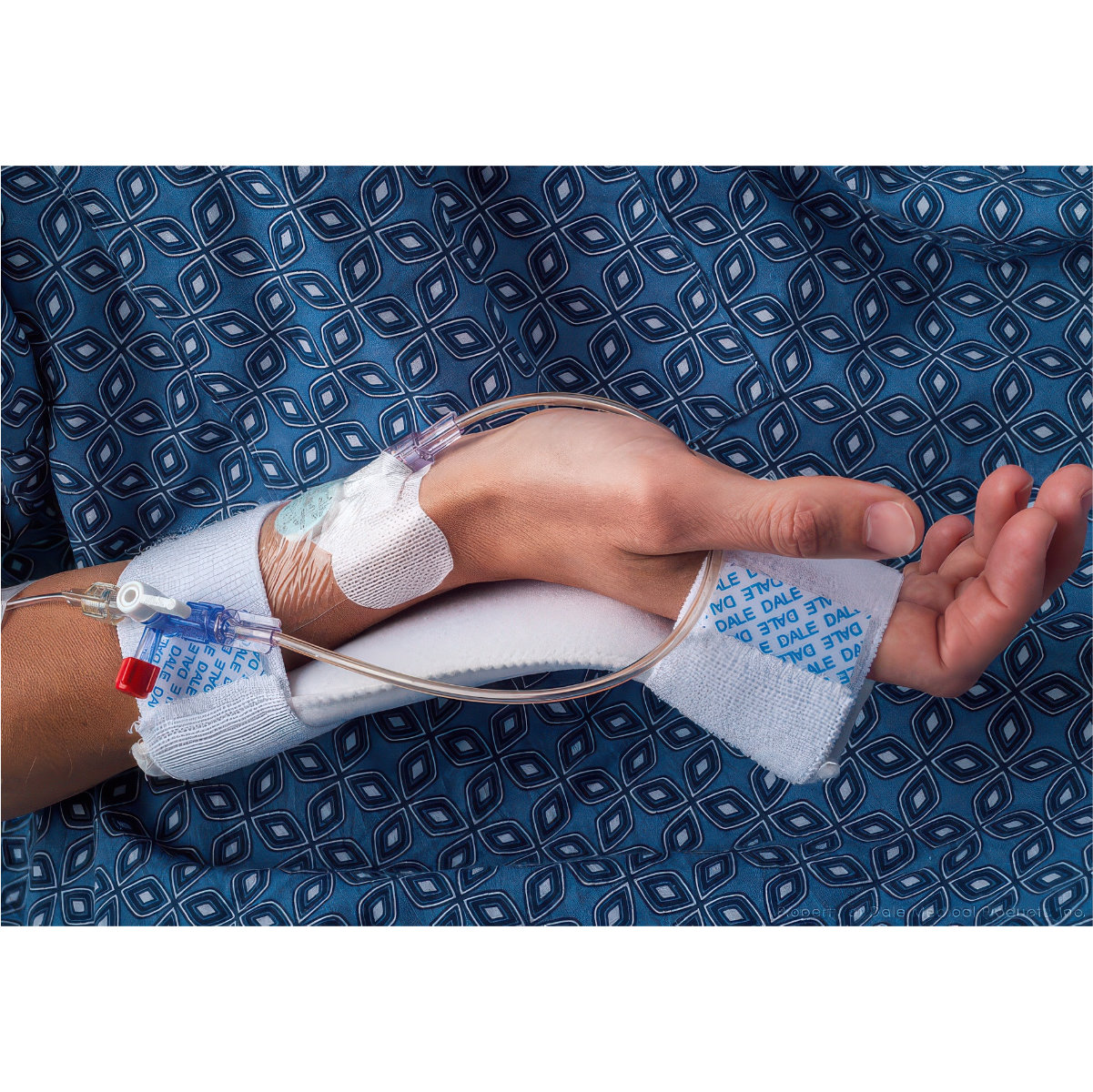 Dale Medical Bendable IV Armboard