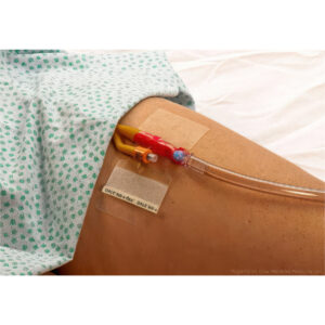 Dale Medical Catheter Holder Adhesive Patch