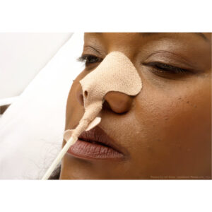 Dale Medical NasoGastric Tube Holders