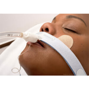 Dale Stabilock Endotracheal Tube Holder