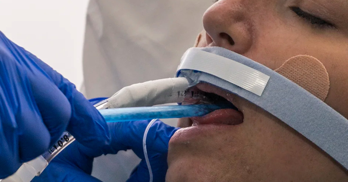 Dale Scrape-n-Suction Tongue Cleaner